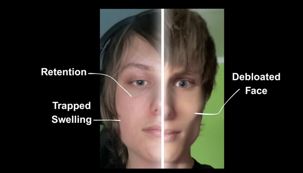 Debloat Method