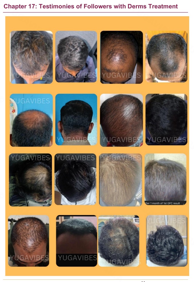 Followers Testimonie